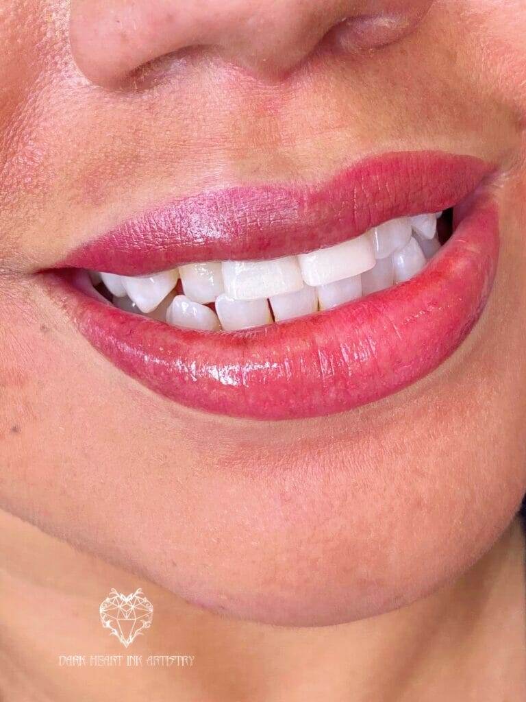 A close up of a woman's mouth with white teeth and dark heart.