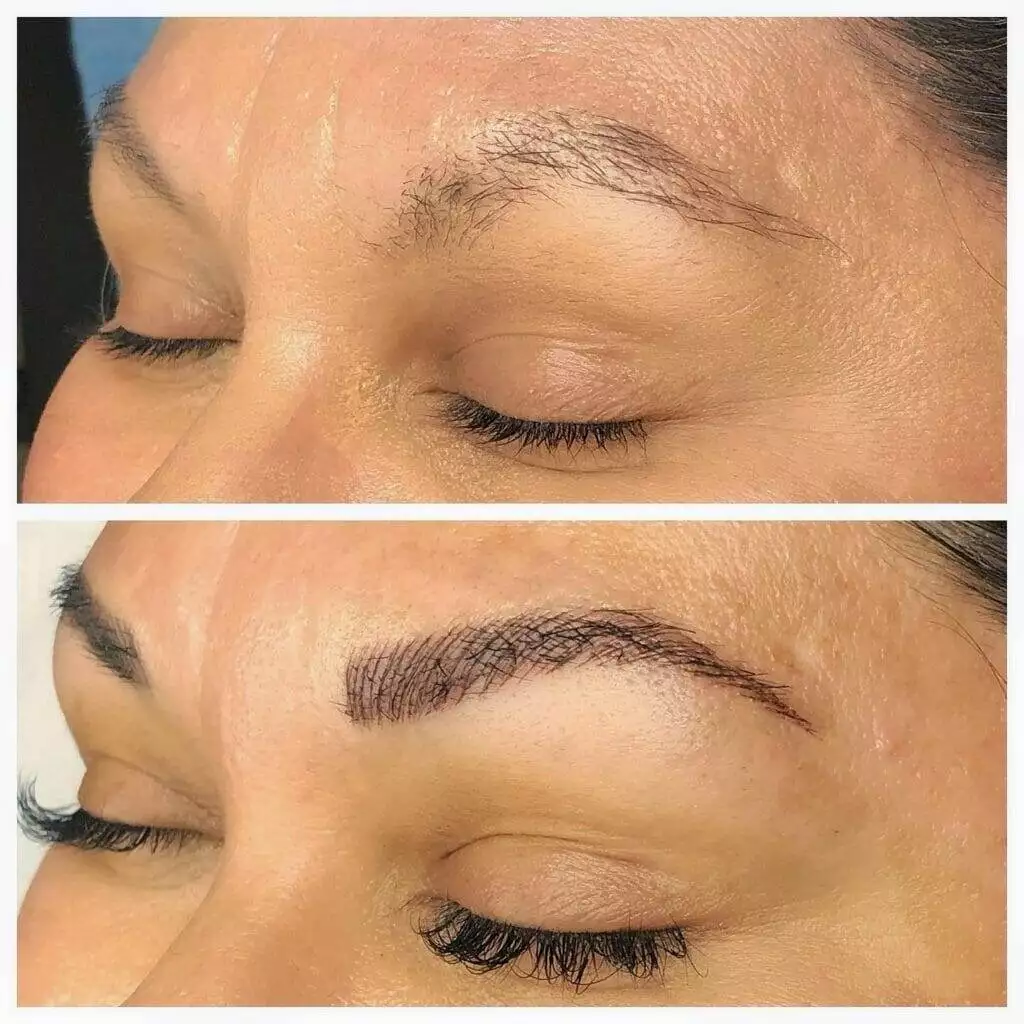 Before and after pictures of Christine Reynolds' eyebrows.