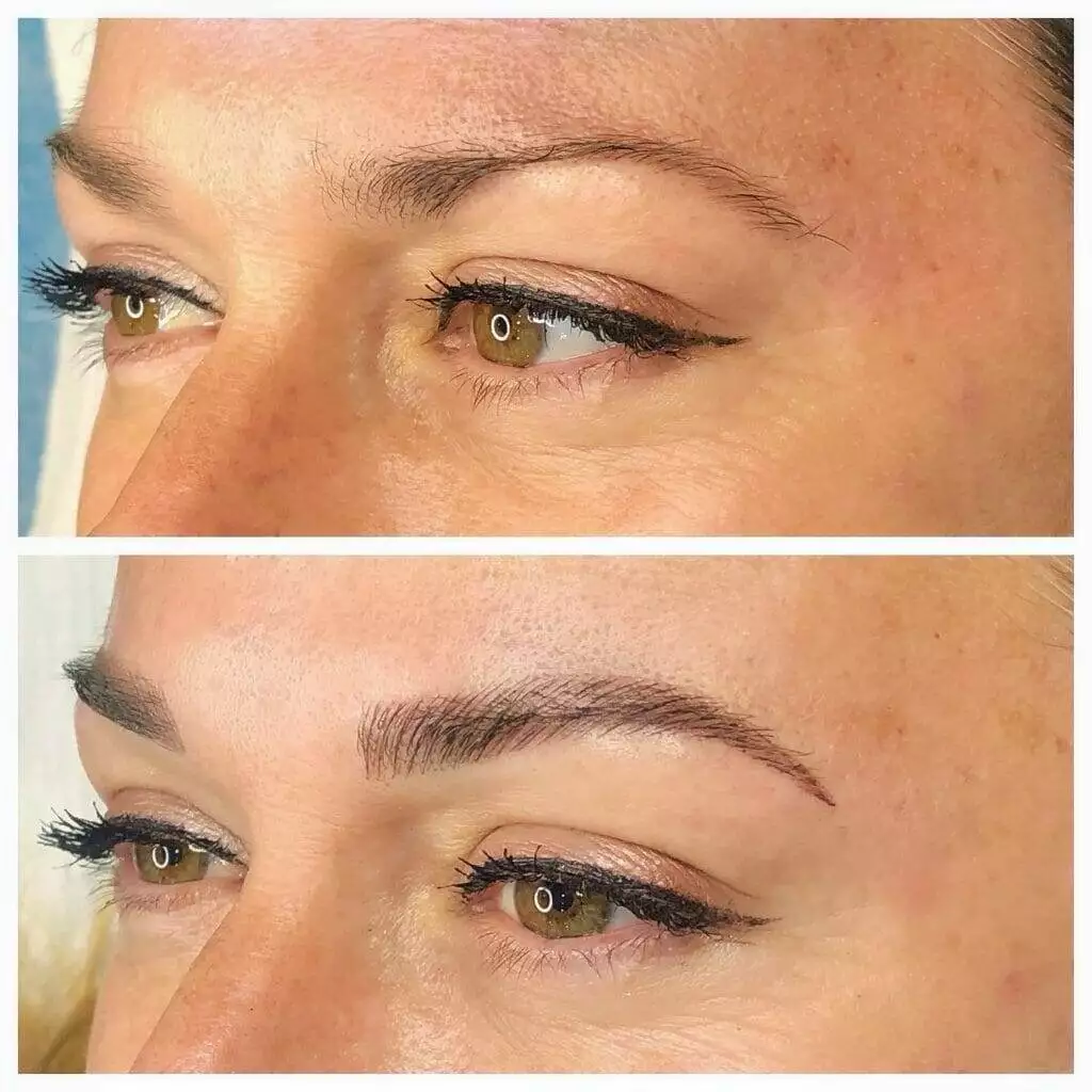 Before and after pictures of Christine Reynolds' eyebrows.