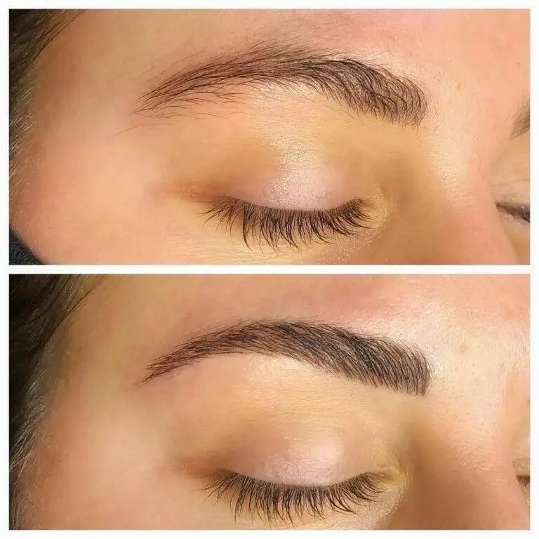 Christine Reynolds's eyebrows before and after treatment.