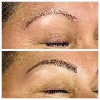 Before and after pictures of Christine Reynolds' eyebrows.