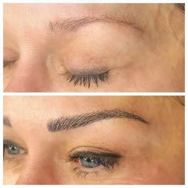 Before and after pictures of Christine Reynolds' eyebrows.