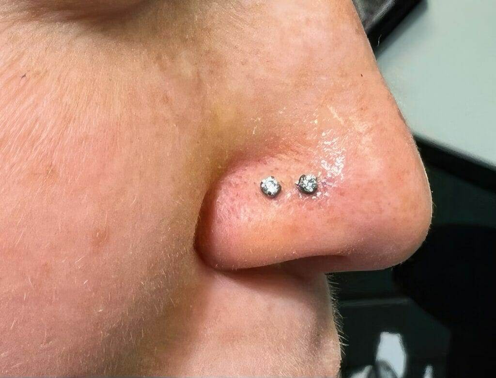 A woman's nose with a diamond piercing, referring to Ronnie Shaw.