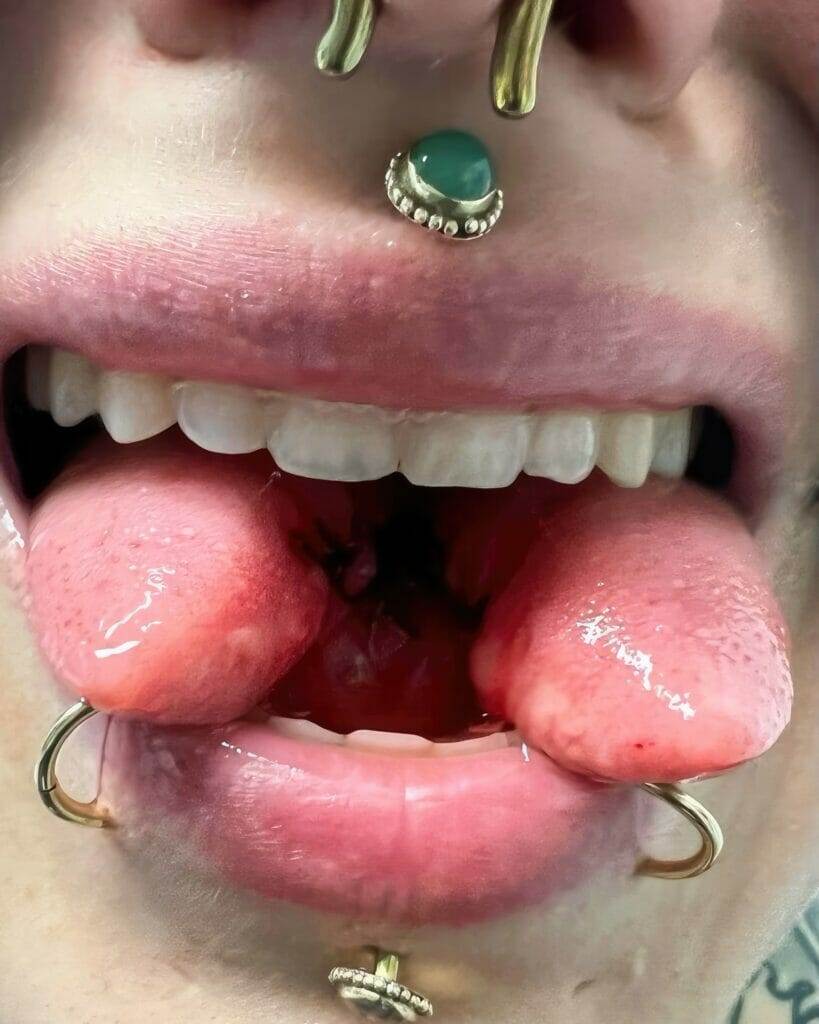 A woman's tongue with piercings on it, featuring Ronnie Shaw.