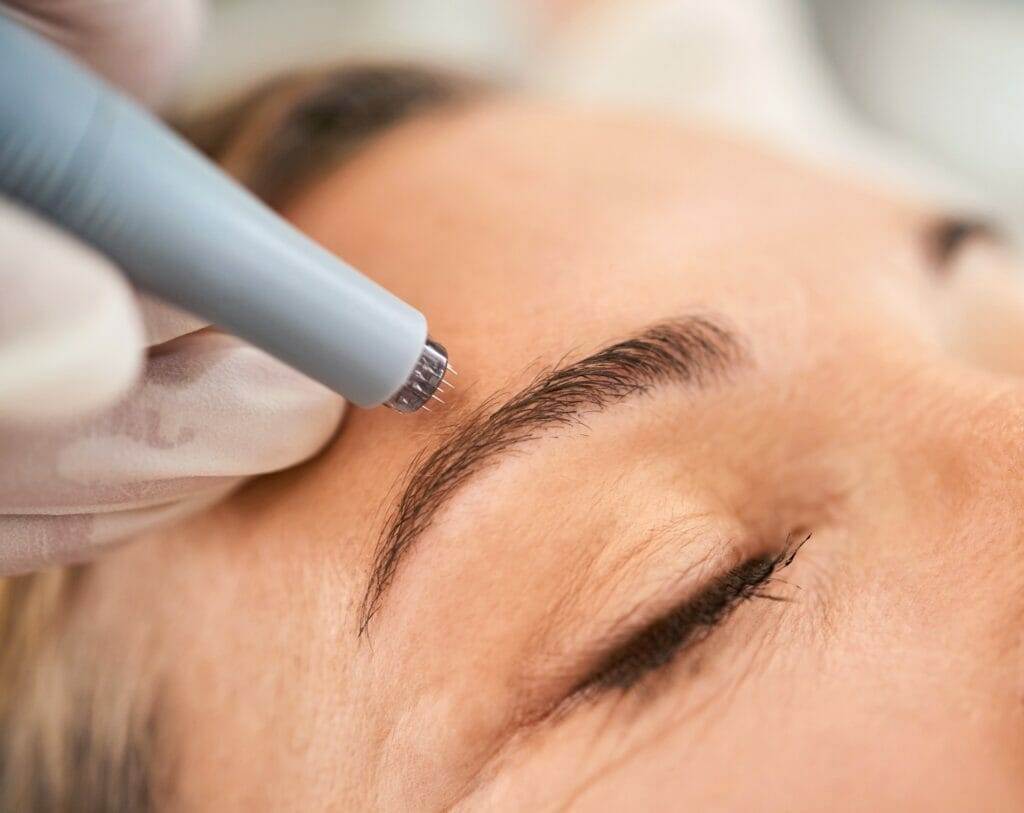 A woman is getting her eyebrows injected at home.